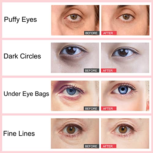 Roc Eye Cream 0.5 oz for Youthful Brightening Effective Results - Image 4