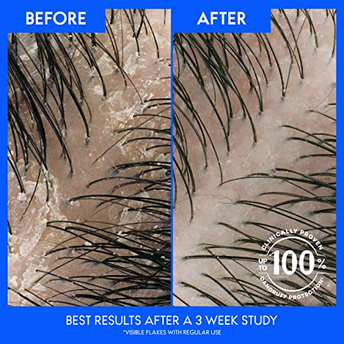 Amway 12 oz Anti-Dandruff Shampoo and Conditioner Set for Flake Control and Hair Nourishment - Image 4