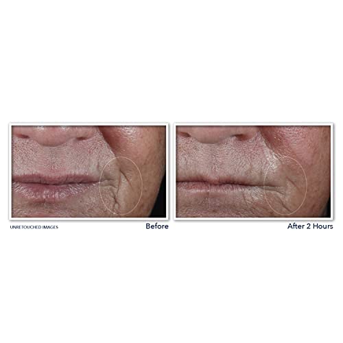 Roc Retinol Deep Wrinkle Eye Cream 0.5 oz for Fine Lines and Dark Circles - Image 7