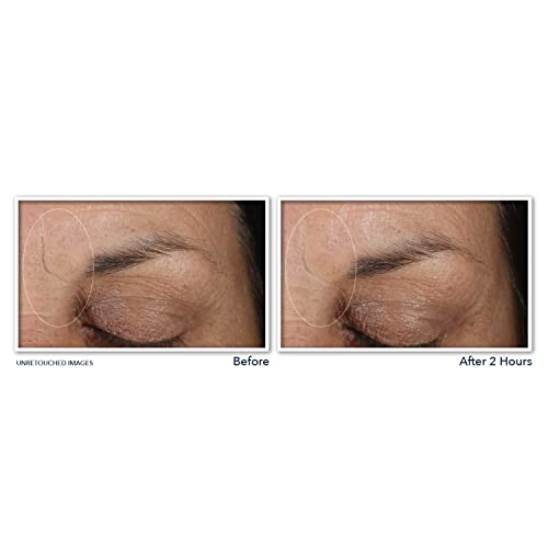 Roc Retinol Deep Wrinkle Eye Cream 0.5 oz for Fine Lines and Dark Circles - Image 6