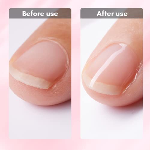 Easy Repair Lifting Gel Nails Kit for Effective Nail Restoration 10ml - Image 5
