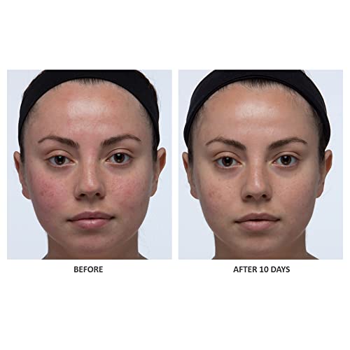 Algenist Color Correcting Anti-Aging Serum Foundation SPF 30 1 oz - Image 4