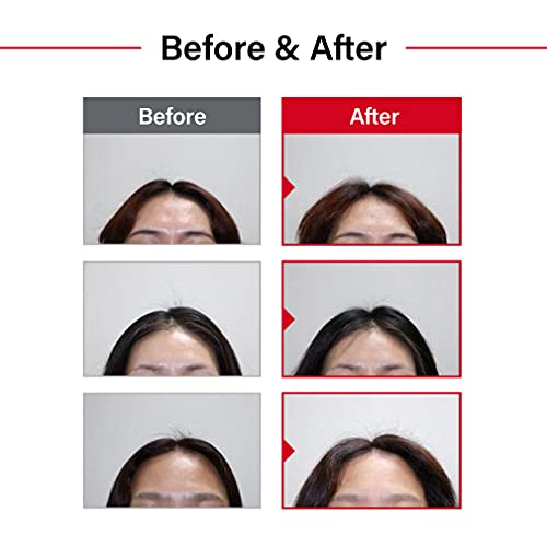 Folligen 8 oz Hair Growth and Strength Cream for Stronger, Healthier Hair - Image 5