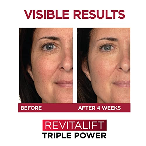 Roc Sensitive Eye Cream with Retinol - Image 7
