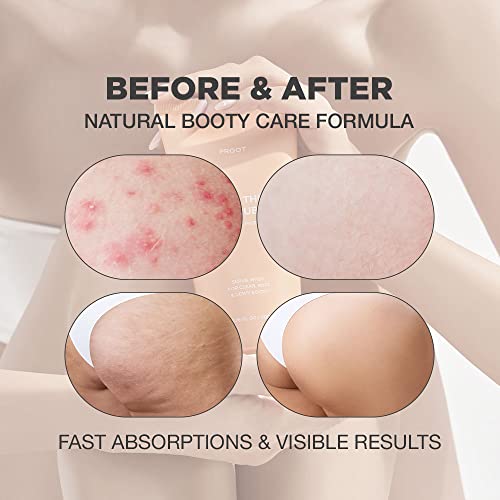 Ingrown Hair Body Scrub: Prevent and treat ingrown hairs. - Image 2
