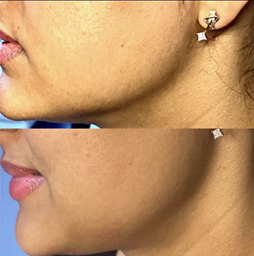 Avocado Face & Hair Mask: Natural Beauty Treatment - Image 5