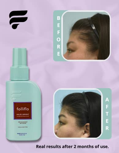 Folligro Hair Spray: Strong hold for all hair types. - Image 3