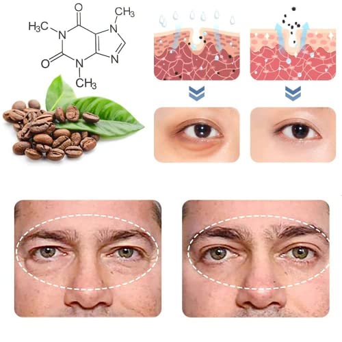 ?Fiore Eye Cream: Awaken tired eyes? - Image 6