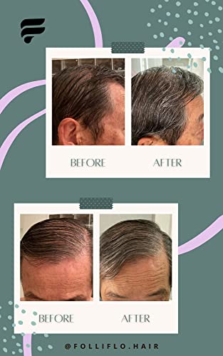 Folligro Hair Spray: Strong hold for all hair types. - Image 4