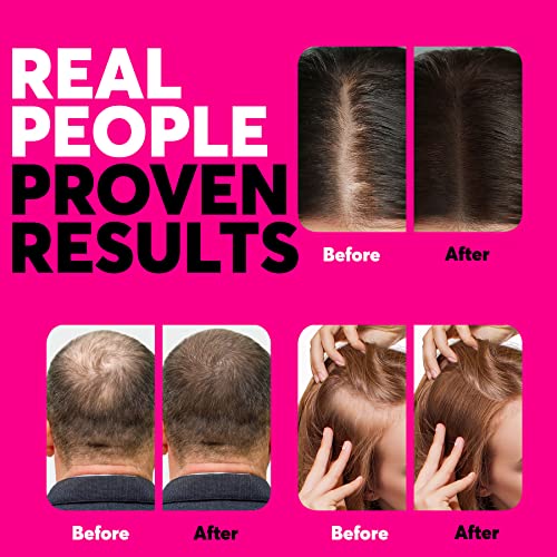 Baldify Hair Volume & Thickness Serum 2 oz Bottle for Fuller Looking Hair - Image 3