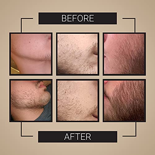 Ordinary Beard Hair Serum 30ml for Softening and Nourishing Facial Hair - Image 3