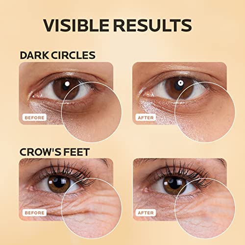 Swanicoco Nourishing 30ml Eye Cream for Hydration and Brightening - Image 5
