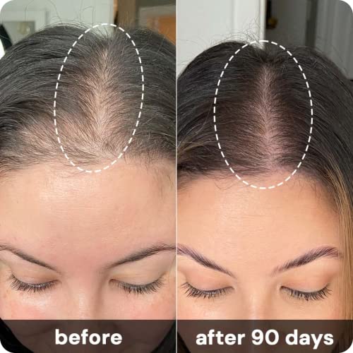 Bdpromax Serum: Hair Benefits & Uses - Image 5