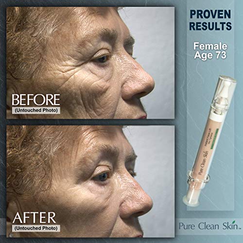 15ml Hydrating Syringe Eye Cream for Dark Circles and Puffiness - Image 5