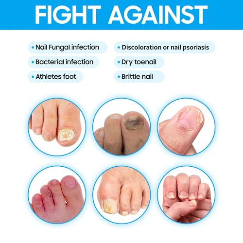 Acrylic Nails Can Cause Fingernail Fungus - Image 2