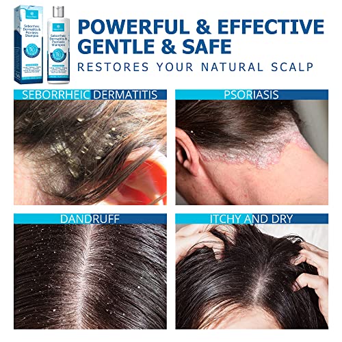 Blue Max Strengthening Hair Serum, 2 oz Bottle, For All Hair Types - Image 5