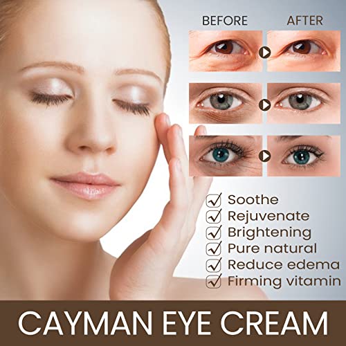 Roc Retinol Eye Cream 0.5 oz Dark Circle & Fine Line Reducer - Image 5