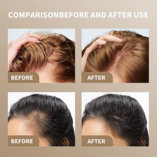 Ayurvedic Anti Dandruff Shampoo and Hair Loss Solution 300ml for Healthy Scalp - Image 3
