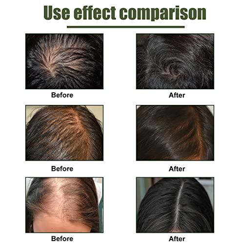 Hair growth spray for thicker, fuller hair. - Image 5