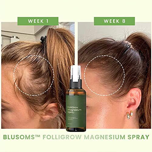 ?Folligrow Spray: Promotes Hair Growth? - Image 3