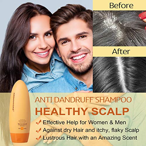 Bioderma Dandruff Shampoo ? Anti-dandruff formula for healthy scalp. - Image 3