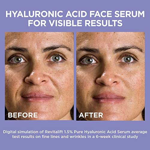 Roc Sensitive Eye Cream with Retinol - Image 6