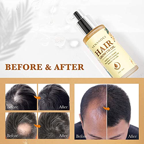Fitish 2 oz Serum for Healthy and Shiny Hair Treatment - Image 6