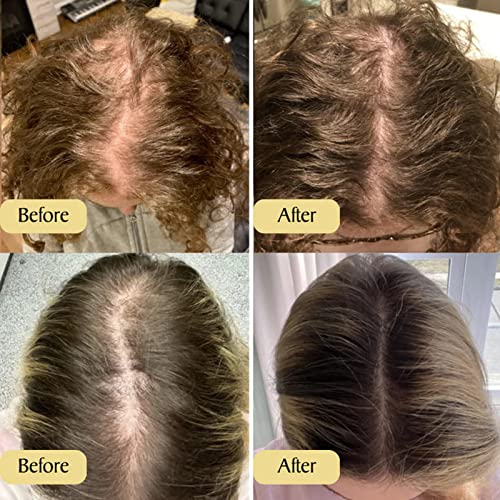 Addicted Beauty 4 oz Nourishing Natural Hair Oil for Healthy Hair Growth - Image 6