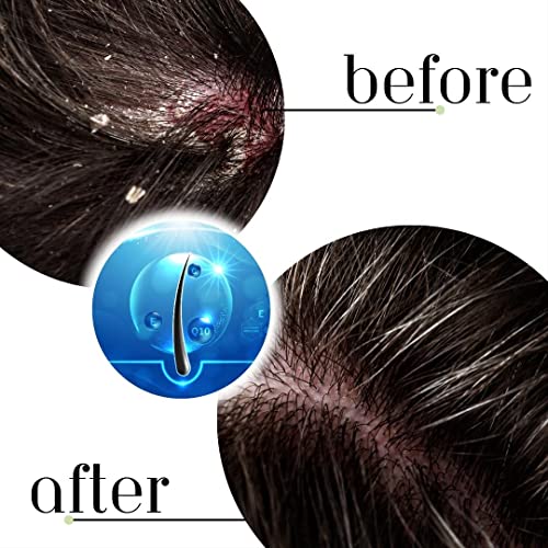 Fino Deep Conditioning Hair Mask 200ml for Damaged Hair Repair - Image 3