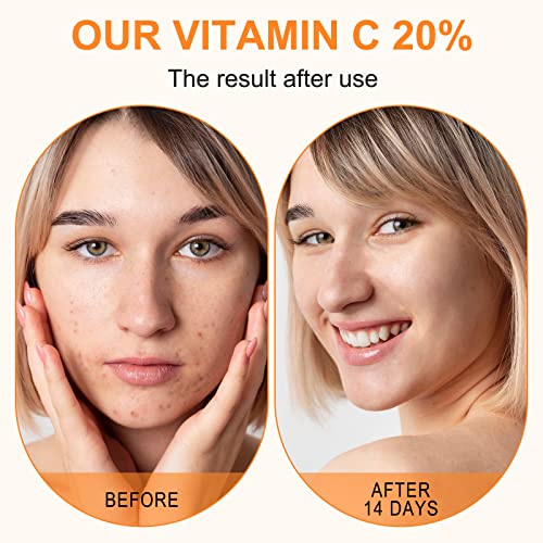 Vitamin C Eye Cream: Brightens and Revitalizes - Image 5
