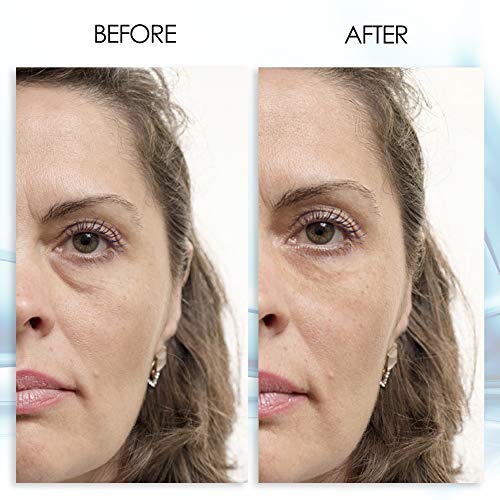 ?Eye Cream for Baggy Eyes? - Image 2