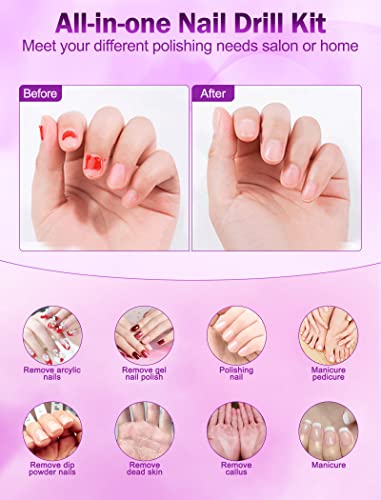 Acryl Gel Nail Kit: All-in-one set for professional results. - Image 7