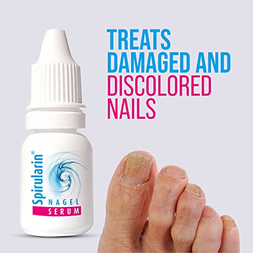 Acrylic Nails Can Cause Fingernail Fungus - Image 6
