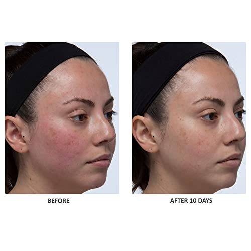 Algenist Color Correcting Anti-Aging Serum Foundation SPF 30 1 oz - Image 3
