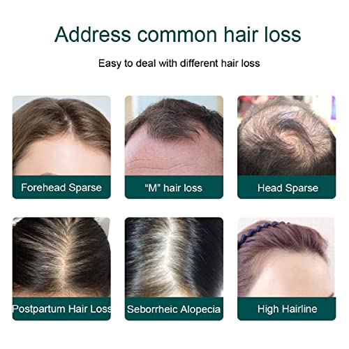 Alpha Follidense 60ml Hair Serum for Thicker, Healthier Hair Growth - Image 7