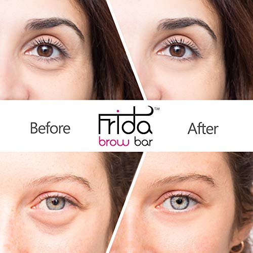 Anteage Eye Cream: Reduces wrinkles, puffiness, and dark circles. - Image 2