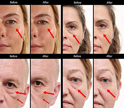 Anteage Eye Cream: Reduces wrinkles, puffiness, and dark circles. - Image 3