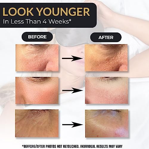 ?Anti Wrinkle Eye Masks for Youthful Skin? - Image 3