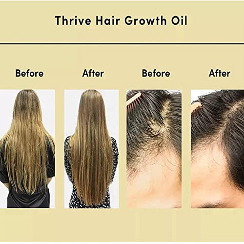 Argan Oil for Hair Regrowth - Image 4
