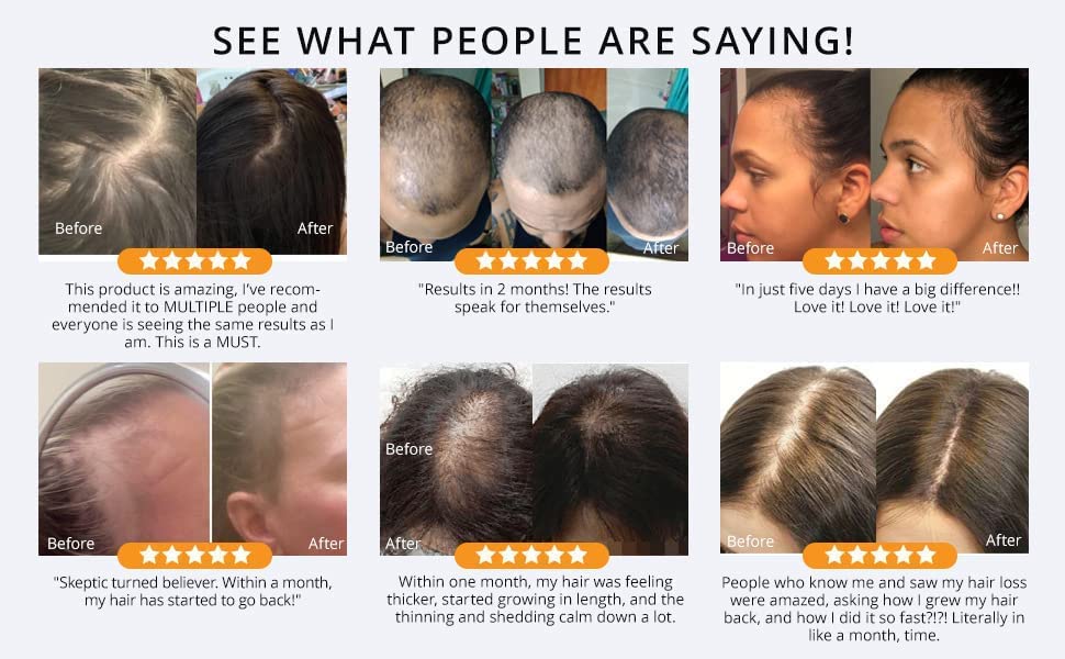 Argan Oil for Hair Regrowth - Image 8