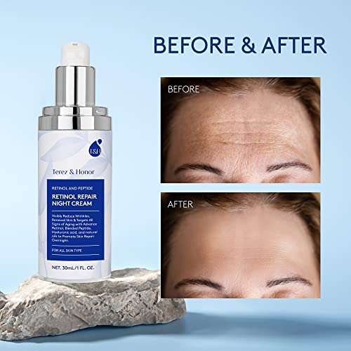 Avocado Retinol Eye Cream 0.5 oz for Youthful Radiant Skin - Image 2
