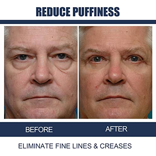 ?Awaken Eye Cream For Brighter, Youthful Eyes? - Image 7