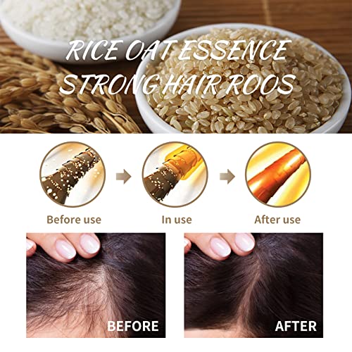 Ayurvedic Anti Dandruff Shampoo and Hair Loss Solution 300ml for Healthy Scalp - Image 2