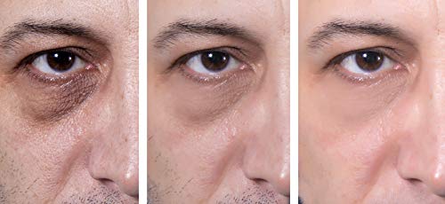 Baebody Eye Cream for Dark Circles Puffiness 0.5 oz Hydrating Formula - Image 7