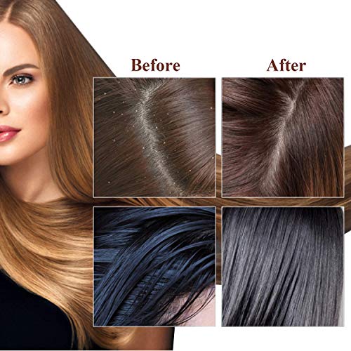 Bioderma Dandruff Shampoo ? Anti-dandruff formula for healthy scalp. - Image 5