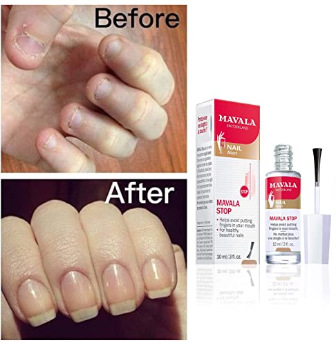 Clear Bitter Nail Polish for Nail Biting Prevention 15ml Size - Image 3