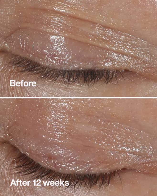 Clinique 0.5 oz Hydrating Eye Cream for Brightening and Smoothing Skin - Image 3