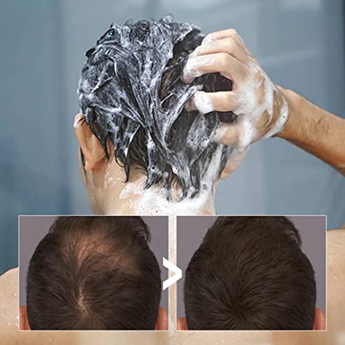 Dandruff & Hair Fall Control Shampoo - Image 2