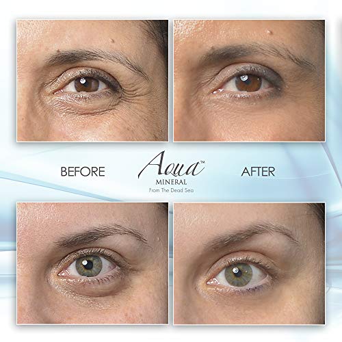 ?Eye Cream for Baggy Eyes? - Image 3