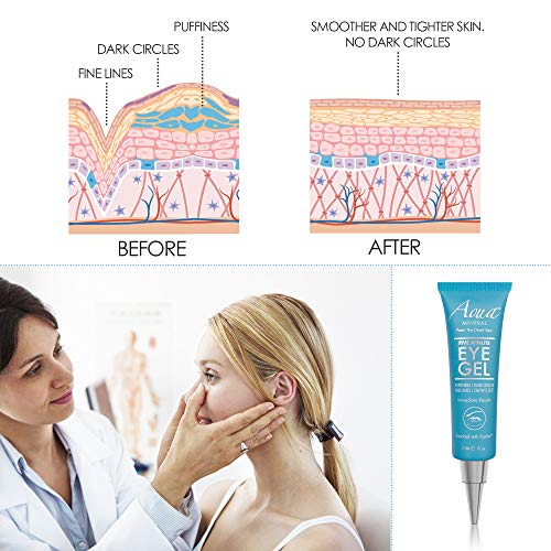?Eye Cream for Baggy Eyes? - Image 7